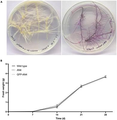 Modifying Anthocyanins Biosynthesis in Tomato Hairy Roots: A Test Bed for Plant Resistance to Ionizing Radiation and Antioxidant Properties in Space